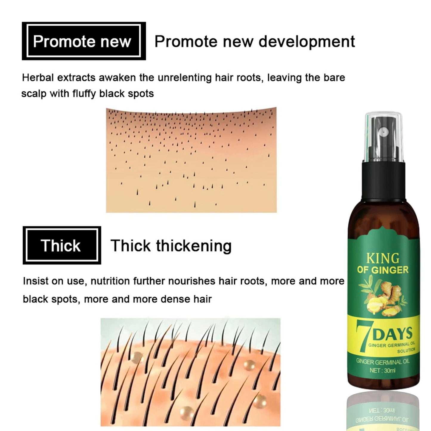 3PCS/5PCS Ginger Hair Growth Essential Oil: Prevent Hair Loss & Thicken Hair