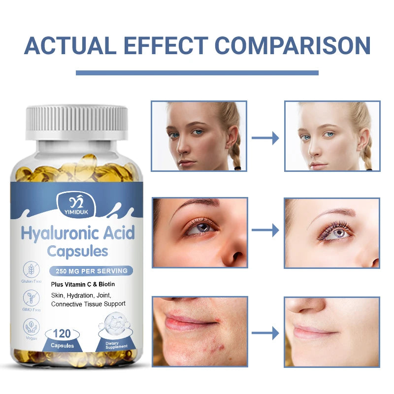 Hyaluronic Acid Capsules: Skin & Joint Care Boost