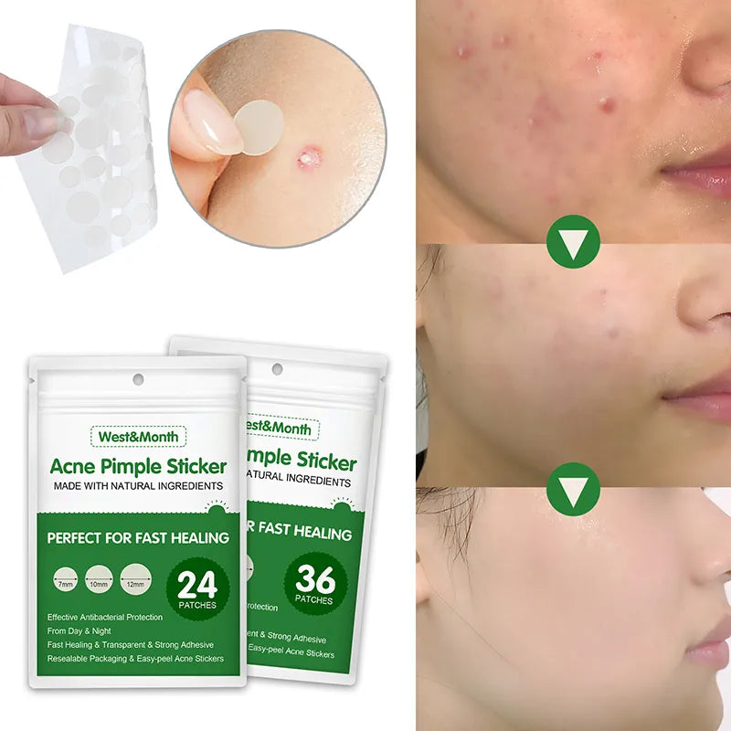 Acne Pimple Remover Patch