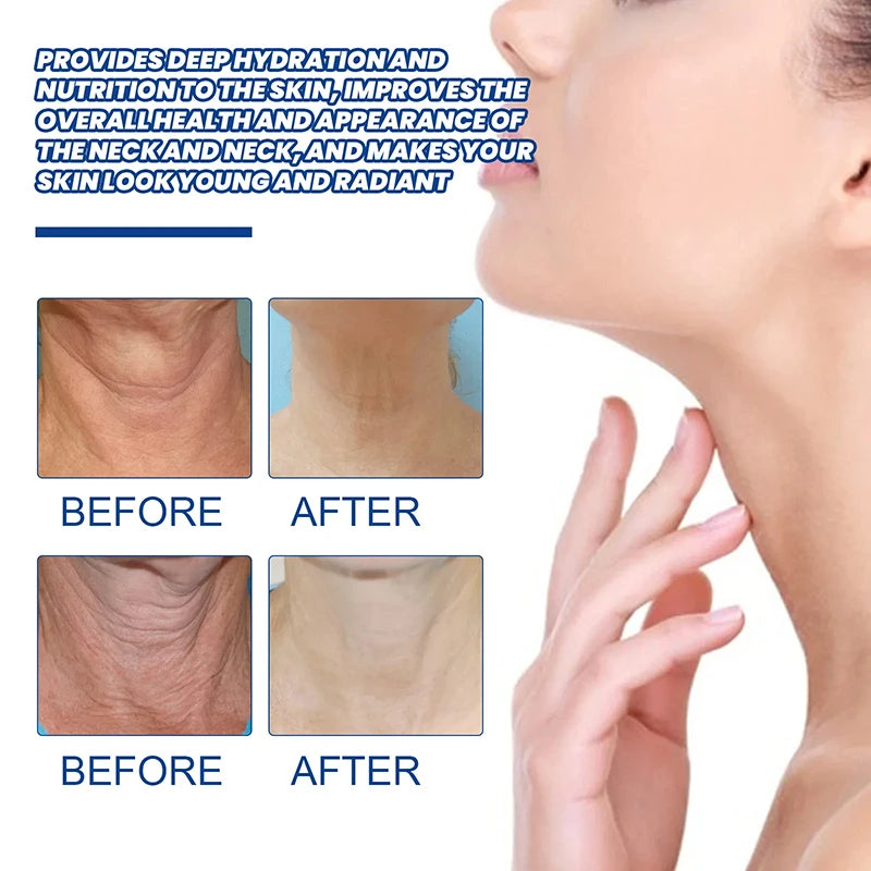 Neck Line Protein Cream: Moisturize, Nourish, Lift - Anti-Aging Rejuvenation