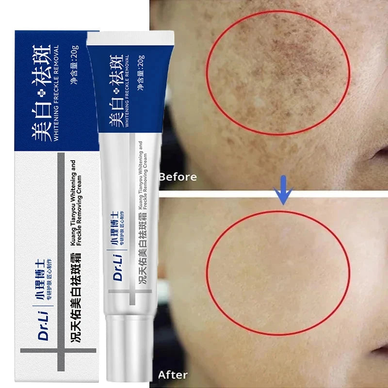 7-Day Melasma & Freckles Whitening Cream: Fade Dark Spots, Brighten Skin - Korean Skincare