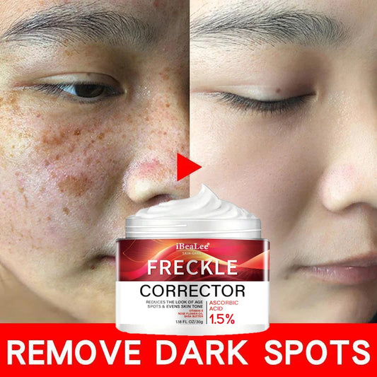 Korean Melasma & Freckle Whitening Cream: Anti-Brown Stain Skincare