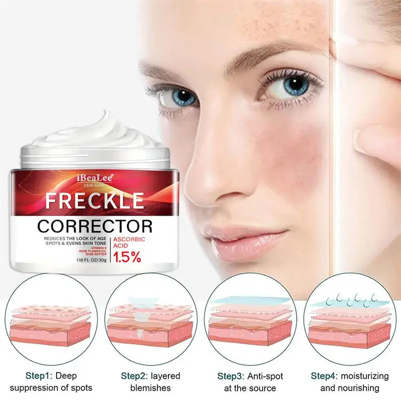 Korean Melasma & Freckle Whitening Cream: Anti-Brown Stain Skincare