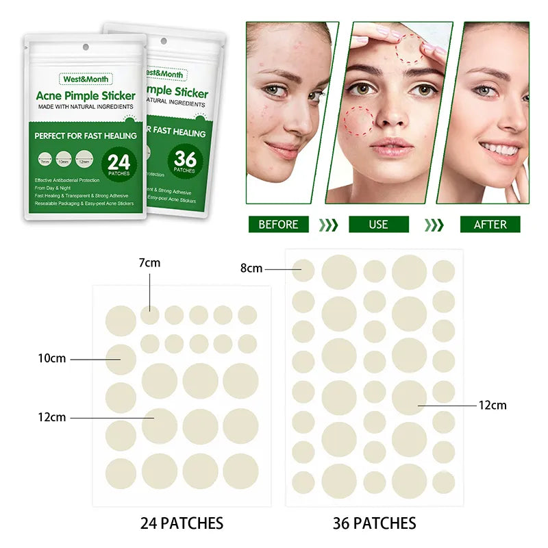 Acne Pimple Remover Patch