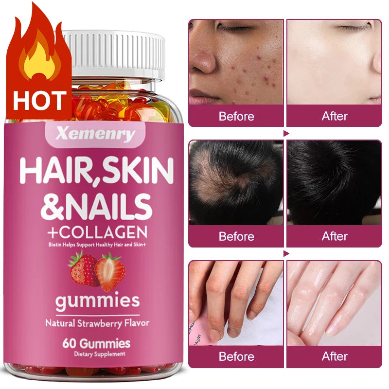 Hair, Skin & Nail Gummies: High Potency Biotin Formula