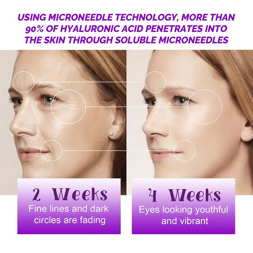 Serum-Infused Microneedle Eye Patches: Anti-Wrinkle, Moisturizing Under Eye Gel Pads