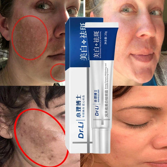 7-Day Melasma & Freckles Whitening Cream: Fade Dark Spots, Brighten Skin - Korean Skincare